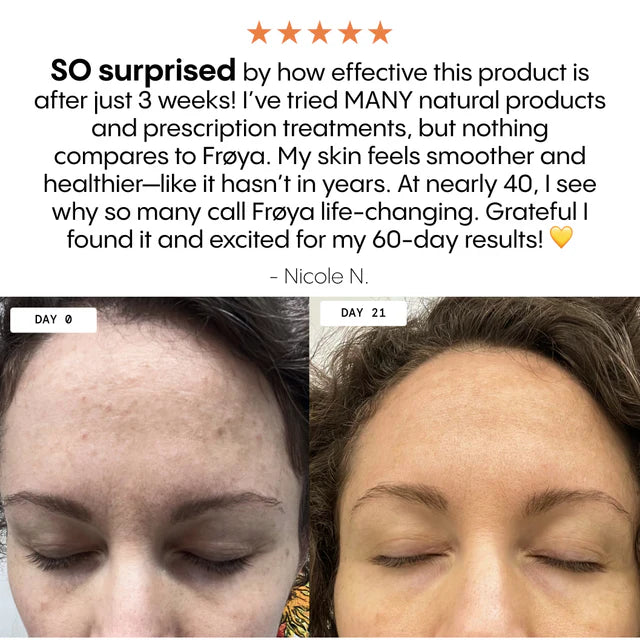 The complete system for the more mature female skin