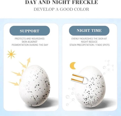 Remove Brown Spots | Freckle Cream | Pigmentation Spot Remover