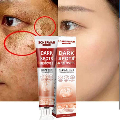 Remove Brown Spots | Freckle Cream | Pigmentation Spot Remover