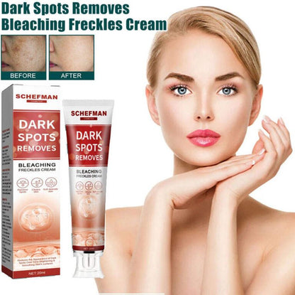 Remove Brown Spots | Freckle Cream | Pigmentation Spot Remover